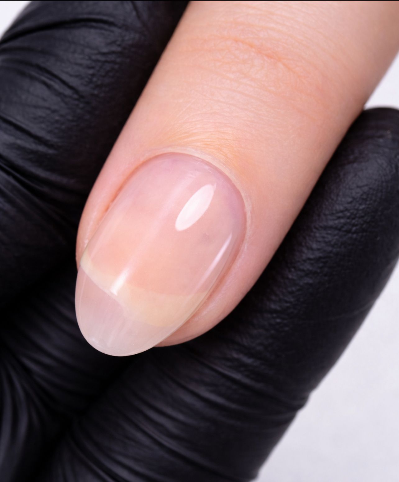 Restauração de unhas danificadas